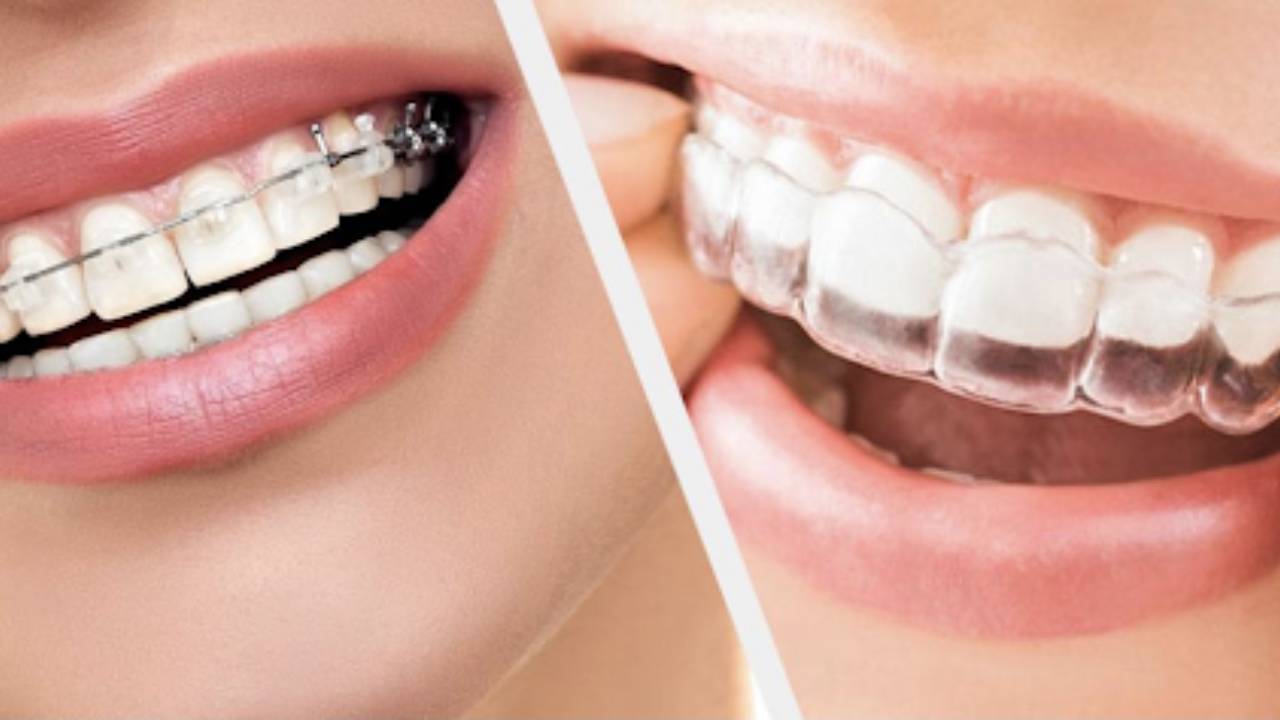 healthy smile